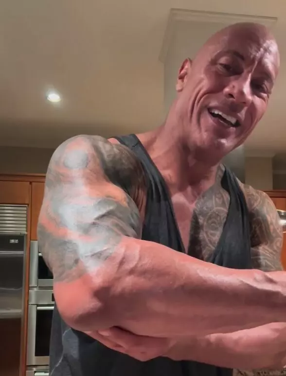 ドウェイン・ジョンソンが撮影中に負傷、腫れた右ひじを見せる | THE RIVER